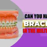 Can You Have Braces in the Military